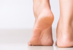 Acide glycolique pour les pieds